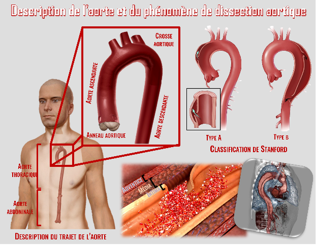 Dissection ao 2